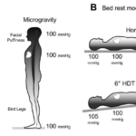 This figure shows how HDT bed rest is used as an analogue for astronauts during long-duration microgravity flight. Credit: Hargens AR et al. 2016.